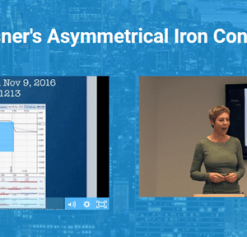 SMB – Amy Meissner – Asymmetrical Iron Condor